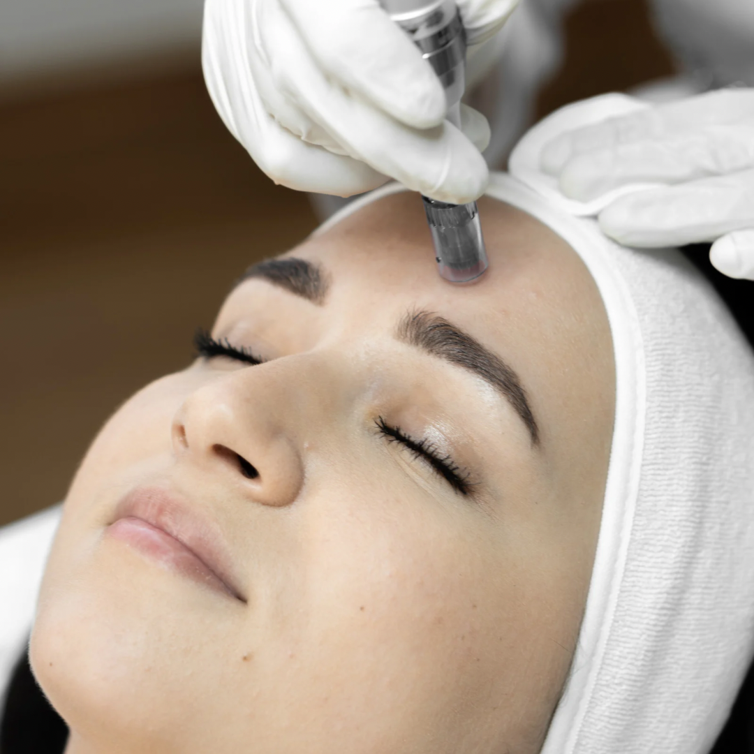 Microneedling4 Microneedling4