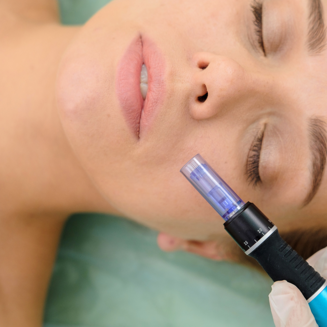 Microneedling6 Microneedling6