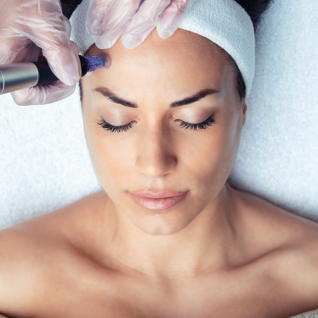Microneedling1 Microneedling1